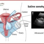 SSG TEST: THE FERTILITY SCAN